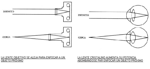 falsa miopia tratamiento